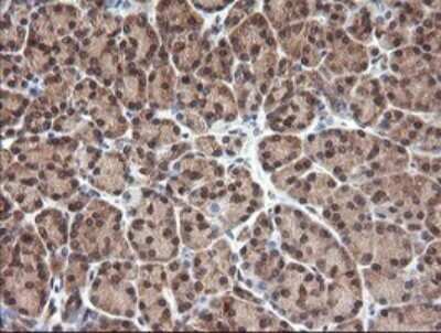 Immunohistochemistry: NDOR1 Antibody (OTI1E3) [NBP2-45856]