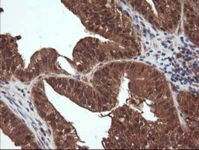 Immunohistochemistry: NDOR1 Antibody (OTI1E3) [NBP2-45856]