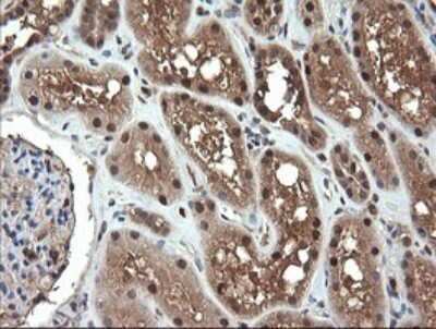 Immunohistochemistry: NDOR1 Antibody (OTI1E3) [NBP2-45856]