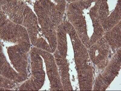 Immunohistochemistry: NDOR1 Antibody (OTI1E3) [NBP2-45856]