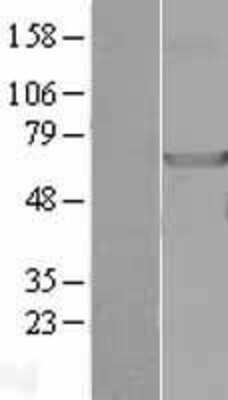 Western Blot: NDOR1 Overexpression Lysate [NBL1-13527]