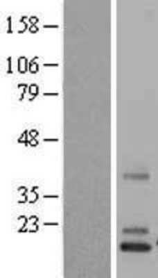 Western Blot: Norrin/NDP Overexpression Lysate [NBL1-13528]