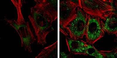 Immunocytochemistry/ Immunofluorescence: NDP52 Antibody (1813) [NBP2-43588]