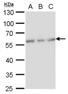 Western Blot: NDP52 Antibody (1813) [NBP2-43588]