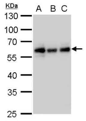 Western Blot: NDP52 Antibody (1813) [NBP2-43588]