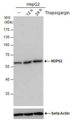 Western Blot: NDP52 Antibody (1813) [NBP2-43588]