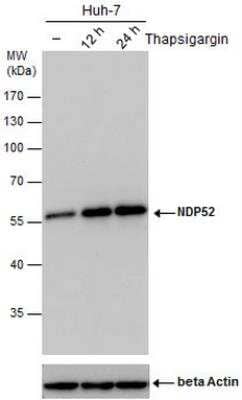 Western Blot: NDP52 Antibody (1813) [NBP2-43588]