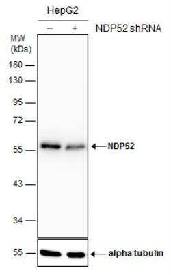 Western Blot: NDP52 Antibody (1813) [NBP2-43588]