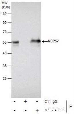 Immunoprecipitation: NDP52 Antibody (422) [NBP2-43696]
