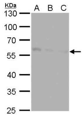 Western Blot: NDP52 Antibody (422) [NBP2-43696]