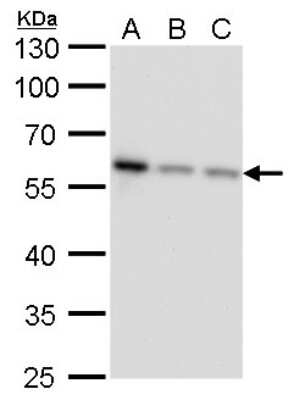 Western Blot: NDP52 Antibody (422) [NBP2-43696]
