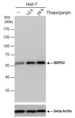 Western Blot: NDP52 Antibody (422) [NBP2-43696]