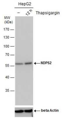 Western Blot: NDP52 Antibody (422) [NBP2-43696]