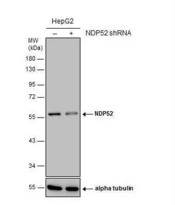 Western Blot: NDP52 Antibody (422) [NBP2-43696]