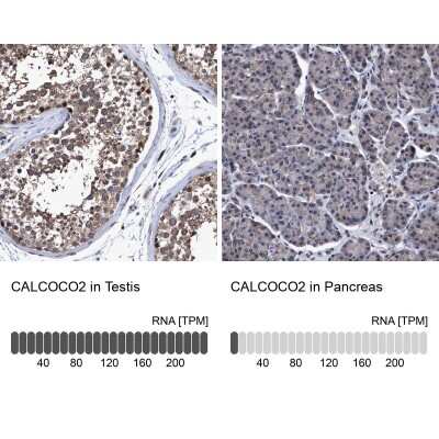 Immunohistochemistry-Paraffin: NDP52 Antibody [NBP1-87872]