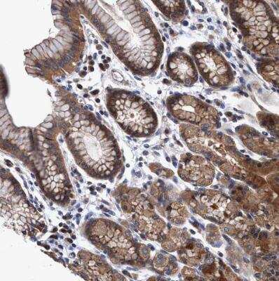 Immunohistochemistry-Paraffin: NDP52 Antibody [NBP1-87872]