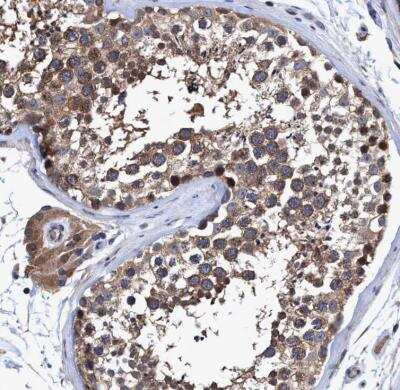 Immunohistochemistry-Paraffin: NDP52 Antibody [NBP1-87872]