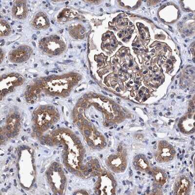 Immunohistochemistry-Paraffin: NDP52 Antibody [NBP1-87872]