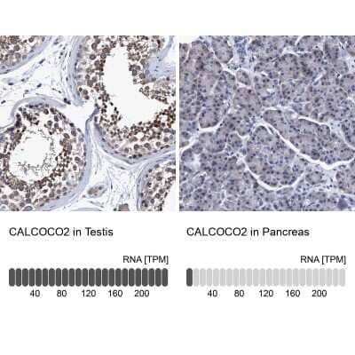 Immunohistochemistry-Paraffin: NDP52 Antibody [NBP1-87873]