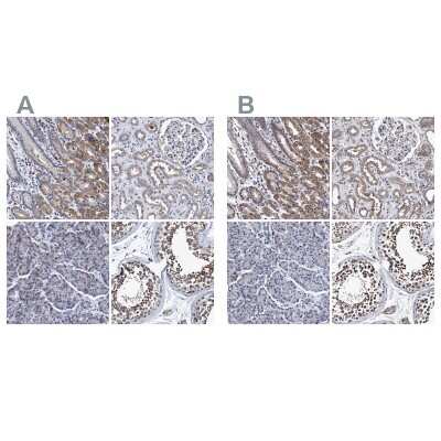 Immunohistochemistry-Paraffin: NDP52 Antibody [NBP1-87873]
