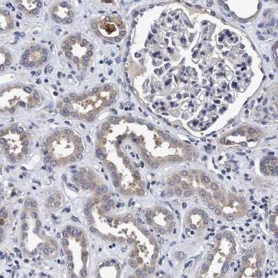 Immunohistochemistry-Paraffin: NDP52 Antibody [NBP1-87873]