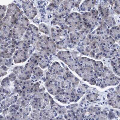 Immunohistochemistry-Paraffin: NDP52 Antibody [NBP1-87873]