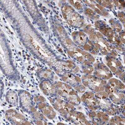 Immunohistochemistry-Paraffin: NDP52 Antibody [NBP1-87873]