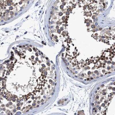 Immunohistochemistry-Paraffin: NDP52 Antibody [NBP1-87873]