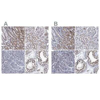 Immunohistochemistry-Paraffin: NDP52 Antibody [NBP1-87874]