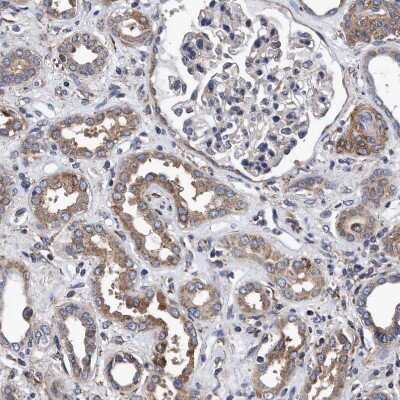 Immunohistochemistry-Paraffin: NDP52 Antibody [NBP1-87874]