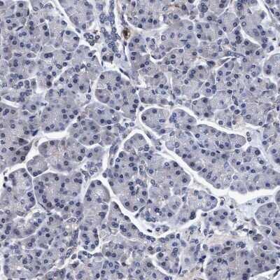Immunohistochemistry-Paraffin: NDP52 Antibody [NBP1-87874]
