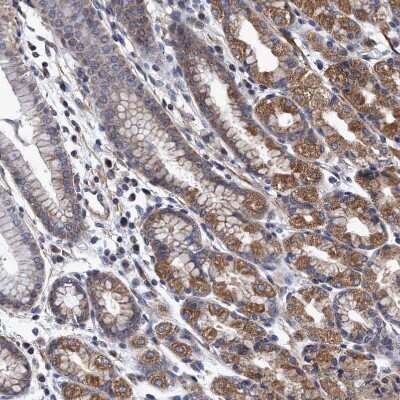 Immunohistochemistry-Paraffin: NDP52 Antibody [NBP1-87874]