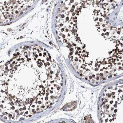 Immunohistochemistry-Paraffin: NDP52 Antibody [NBP1-87874]