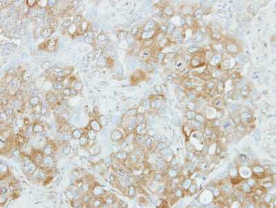 Immunohistochemistry-Paraffin: NDP52 Antibody [NBP2-19499]