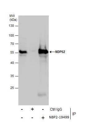 Immunoprecipitation: NDP52 Antibody [NBP2-19499]
