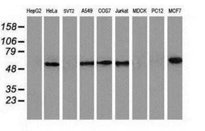 Western Blot: NDP52 Antibody (OTI4H5)Azide and BSA Free [NBP2-72897]