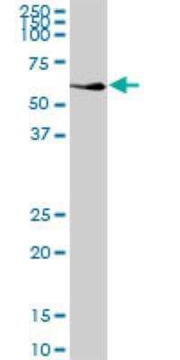 Western Blot: NDP52 Antibody [H00010241-B01P]