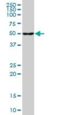 Western Blot: NDP52 Antibody [H00010241-B01P]