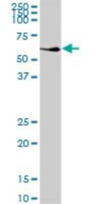 Western Blot: NDP52 Antibody [H00010241-B01P]
