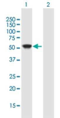 Western Blot: NDP52 Antibody [H00010241-B01P]