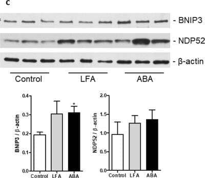 Western Blot: NDP52 Antibody [H00010241-B01P]