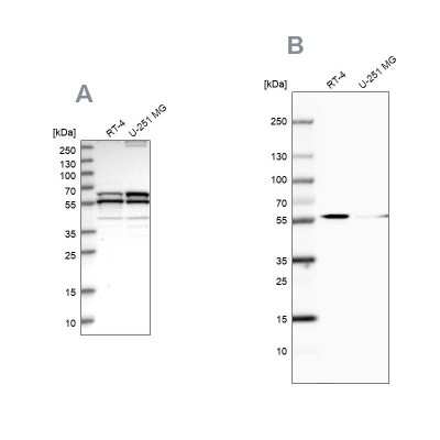 Western Blot: NDP52 Antibody [NBP1-87874]