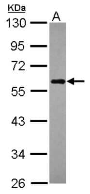 Western Blot: NDP52 Antibody [NBP2-19499]