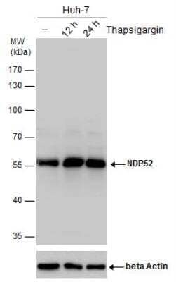 Western Blot: NDP52 Antibody [NBP2-19499]