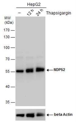 Western Blot: NDP52 Antibody [NBP2-19499]