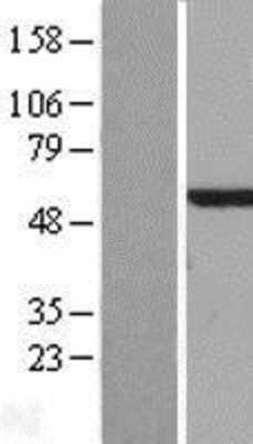 Western Blot: NDP52 Overexpression Lysate [NBL1-08646]