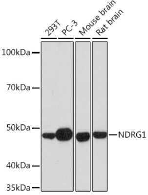 Western Blot: NDRG1 Antibody (2C6K6) [NBP3-16321]