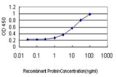 ELISA: NDRG1 Antibody (2D7) [H00010397-M03]