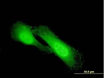 Immunocytochemistry/ Immunofluorescence: NDRG1 Antibody (2D7) [H00010397-M03]