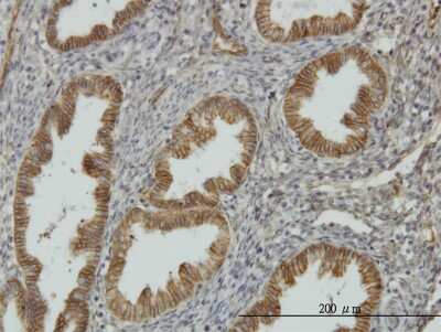 Immunohistochemistry-Paraffin: NDRG1 Antibody (2D7) [H00010397-M03]
